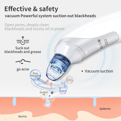 Home Use Electric Blackhead Remover | Vacuum Suction Beauty Instrument