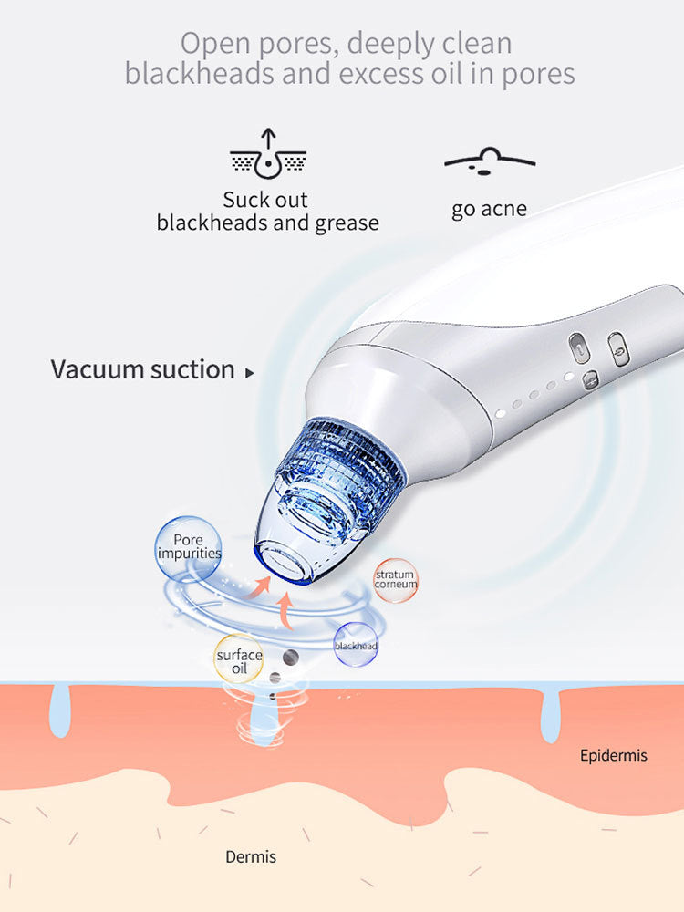 Home Use Electric Blackhead Remover | Vacuum Suction Beauty Instrument